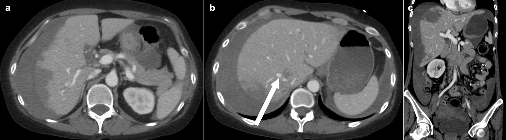 Fig. 2