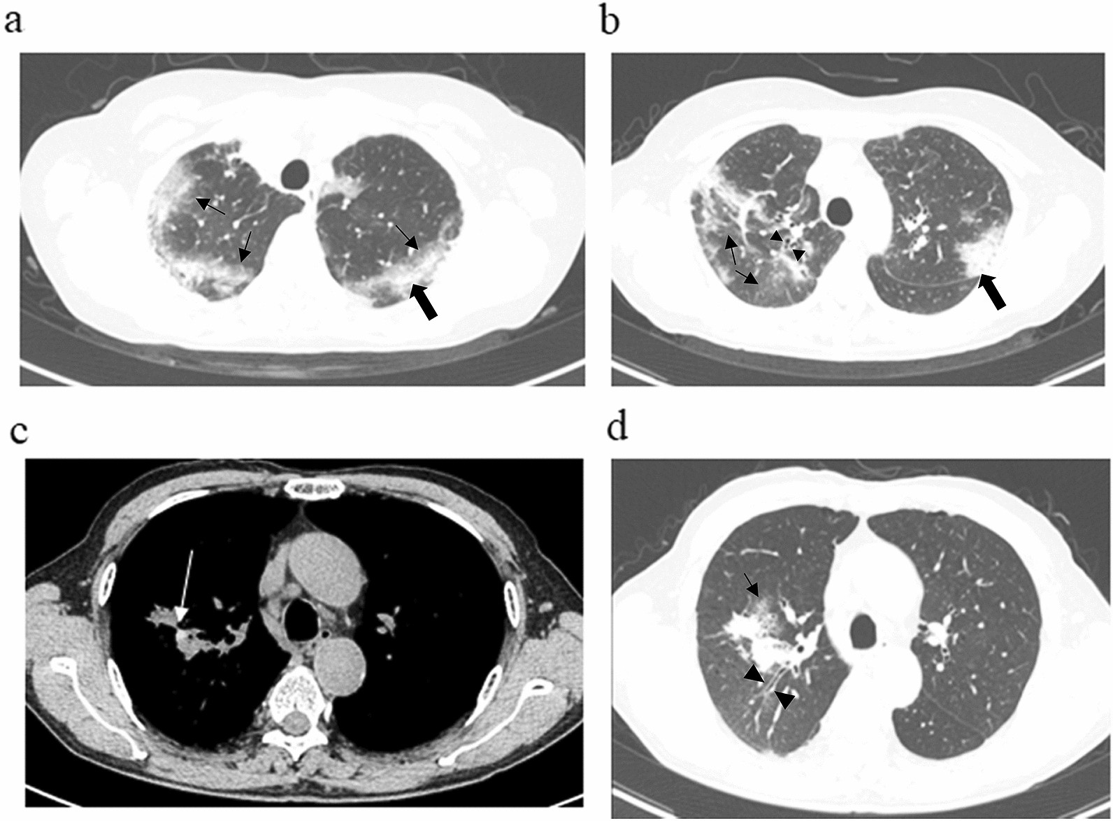 Fig. 1