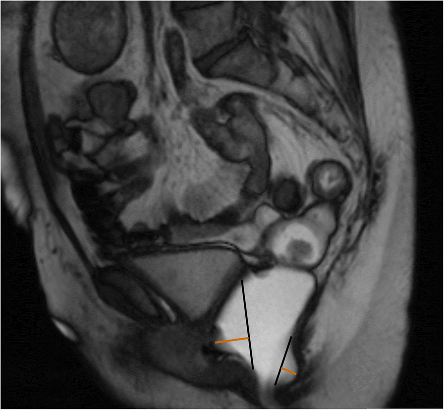 Fig. 12