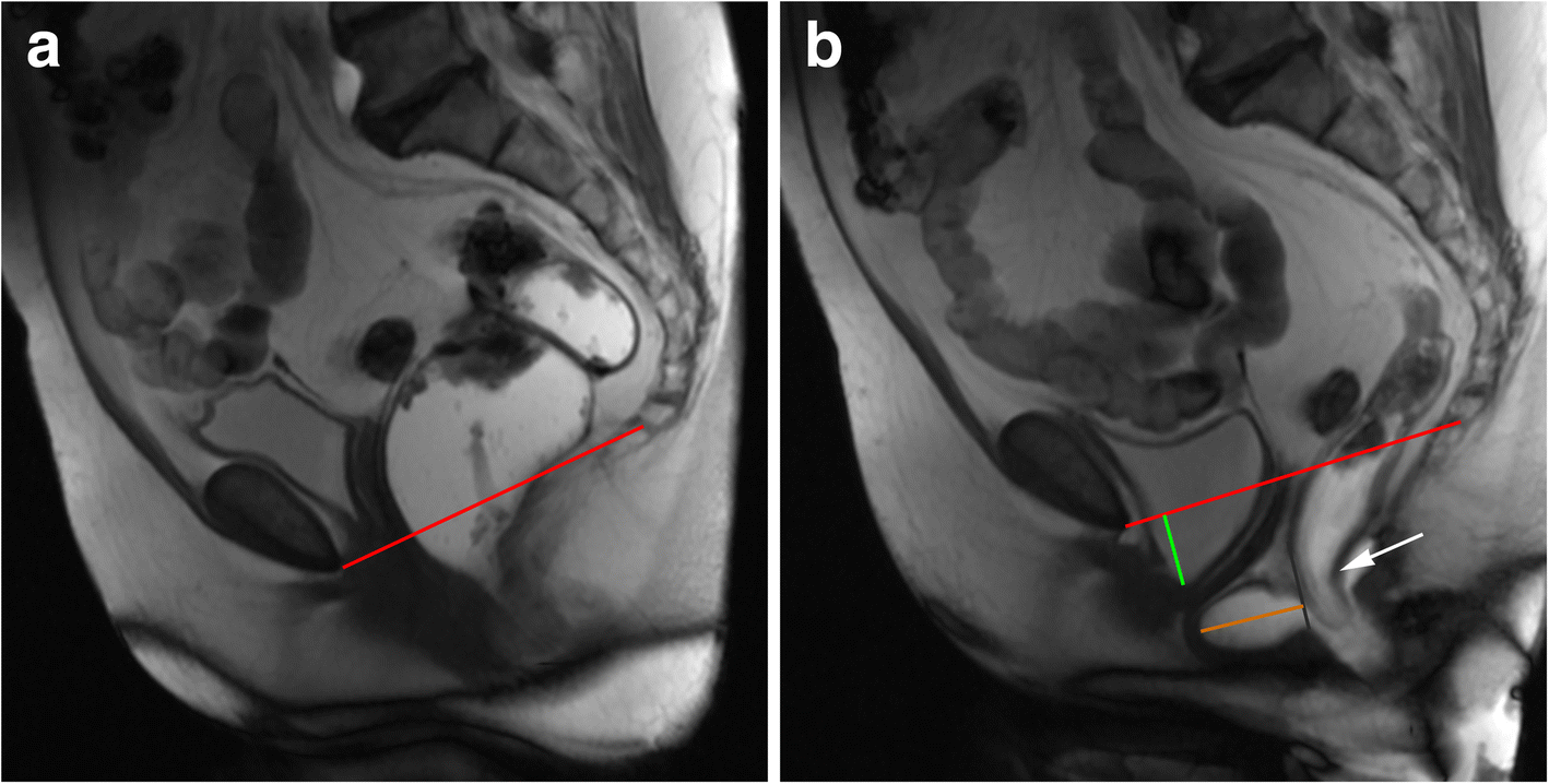 Fig. 13