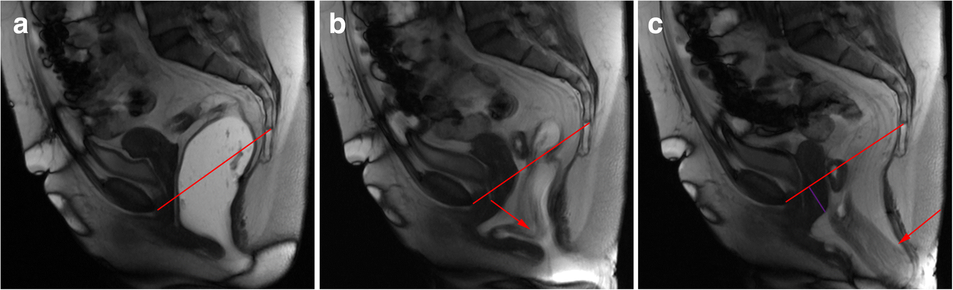 Fig. 14