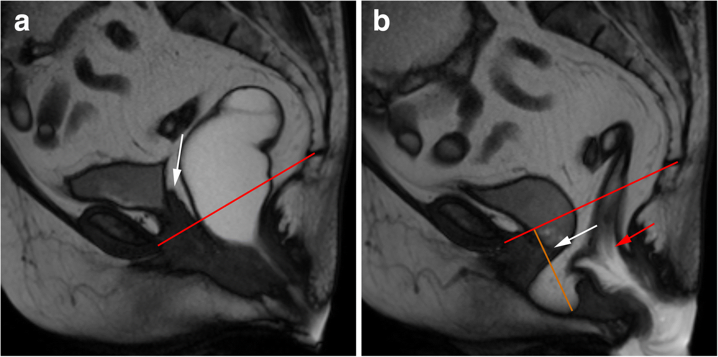 Fig. 15