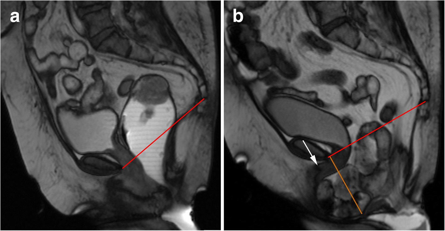 Fig. 16