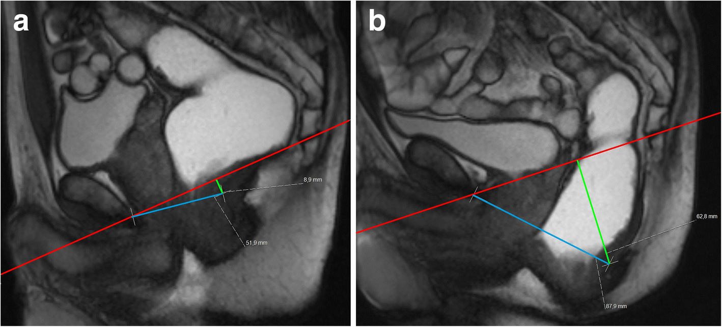 Fig. 20