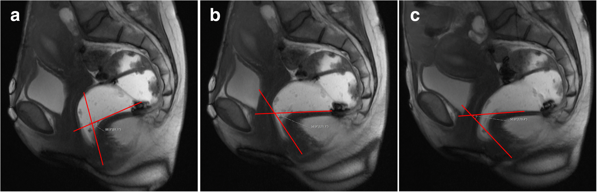 Fig. 21