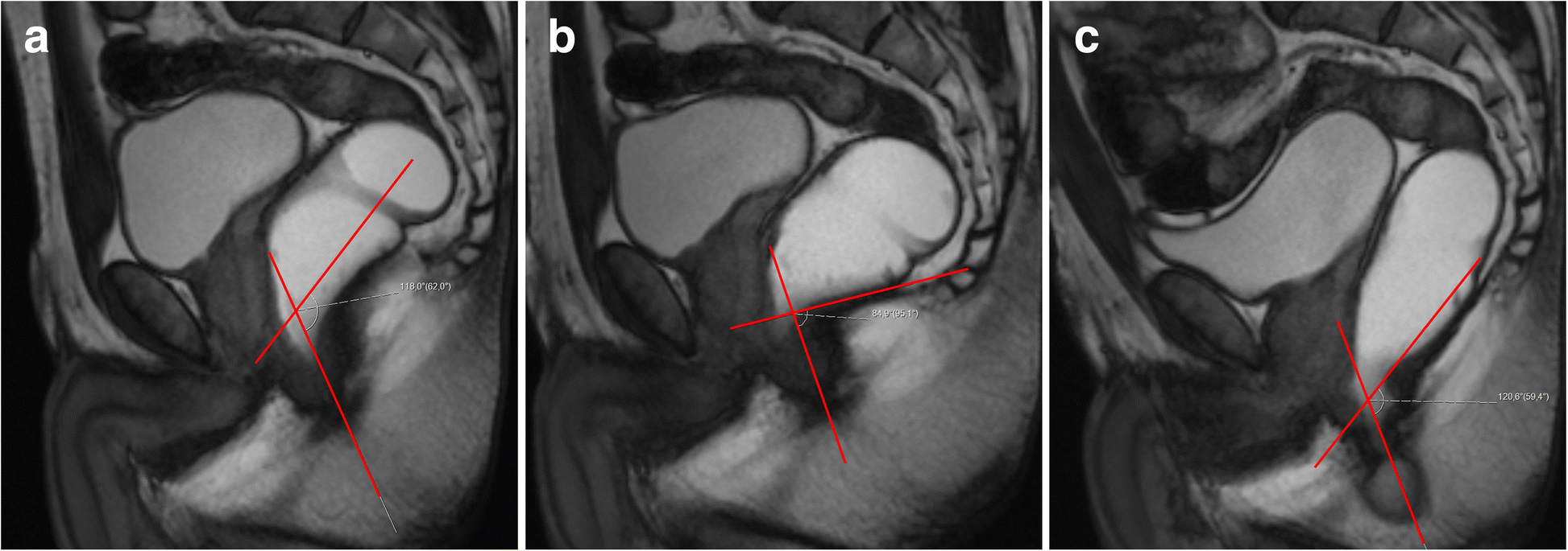 Figure 22 Dynamic Magnetic Resonance Imaging Of The Female