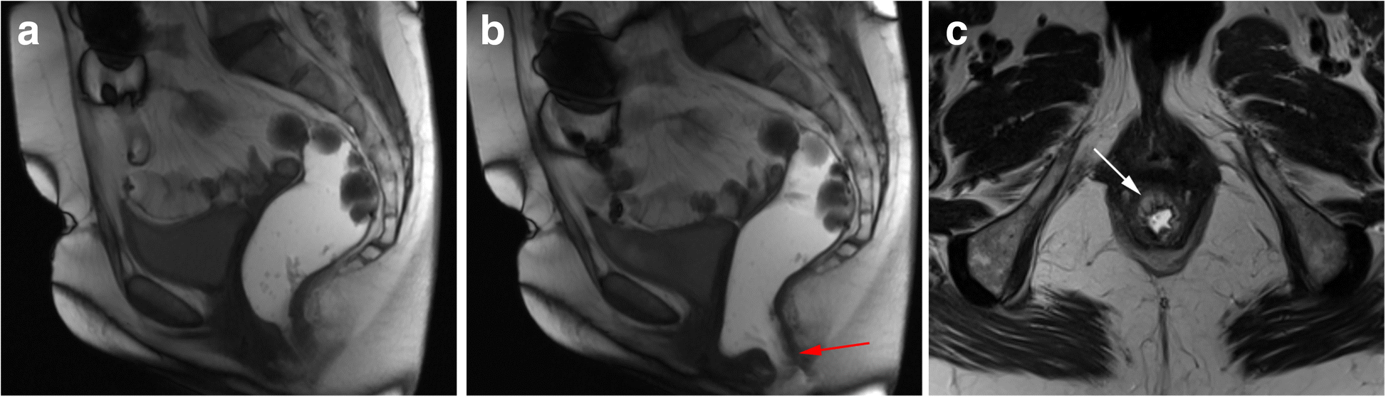 Fig. 23