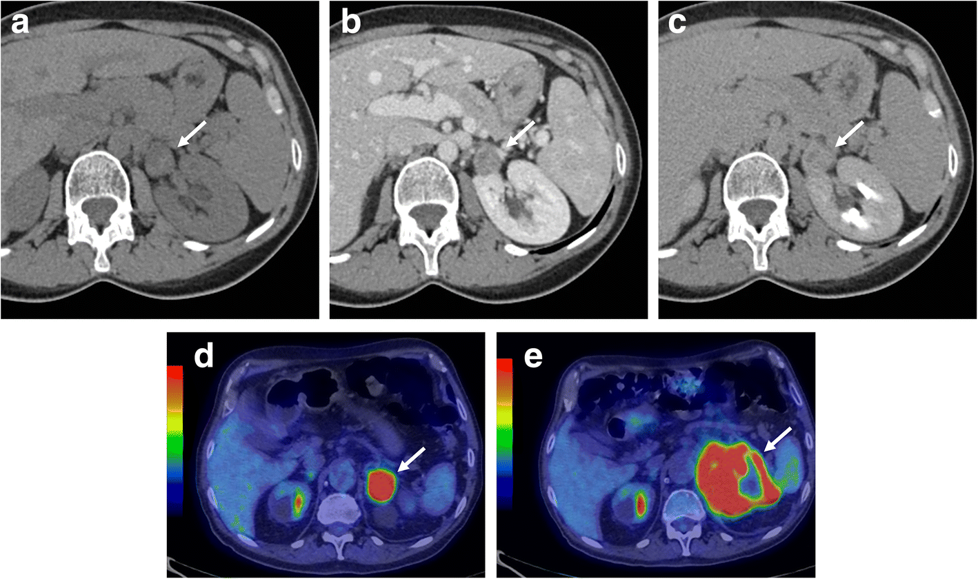 Fig. 10