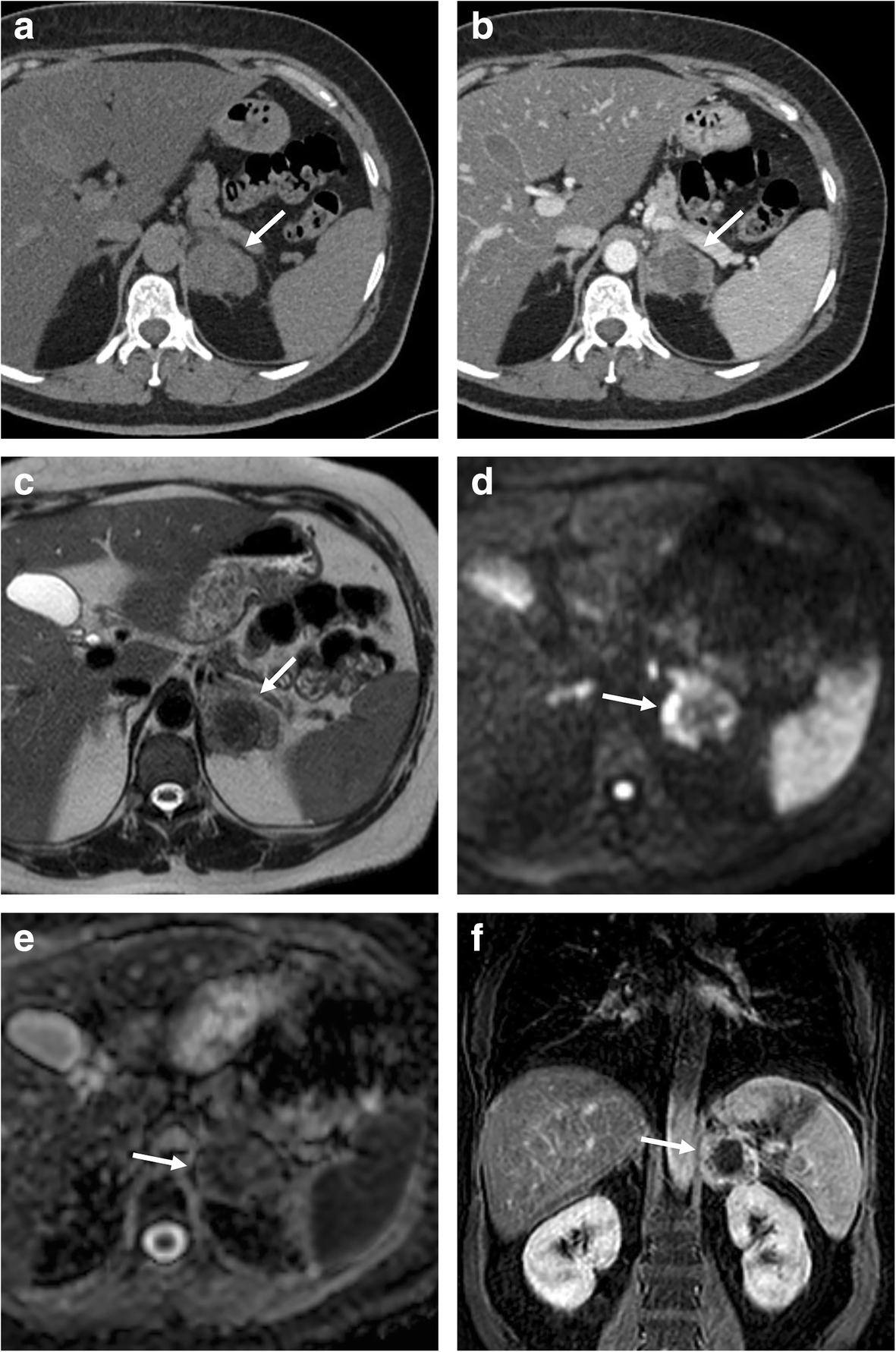 Fig. 11