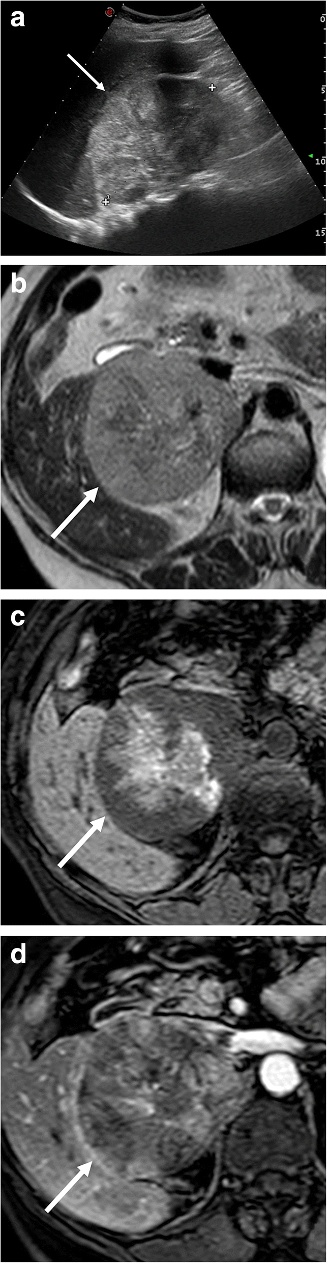 Fig. 8