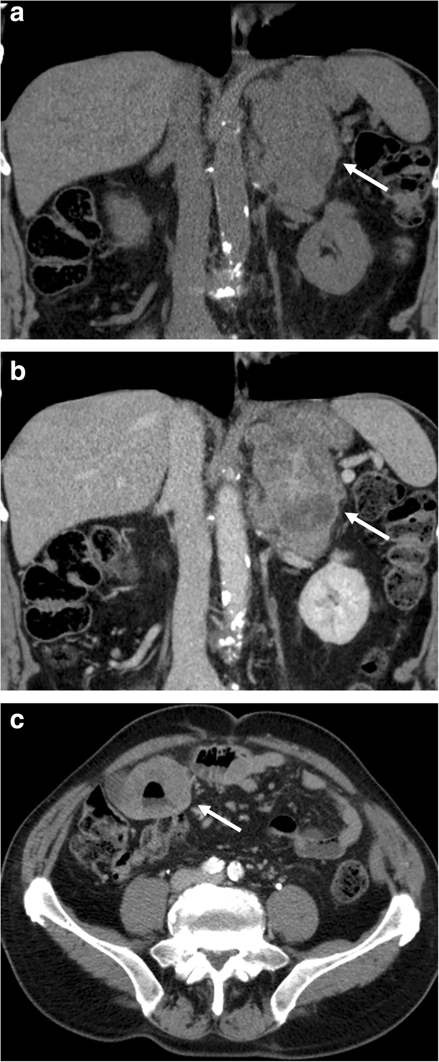 Fig. 9