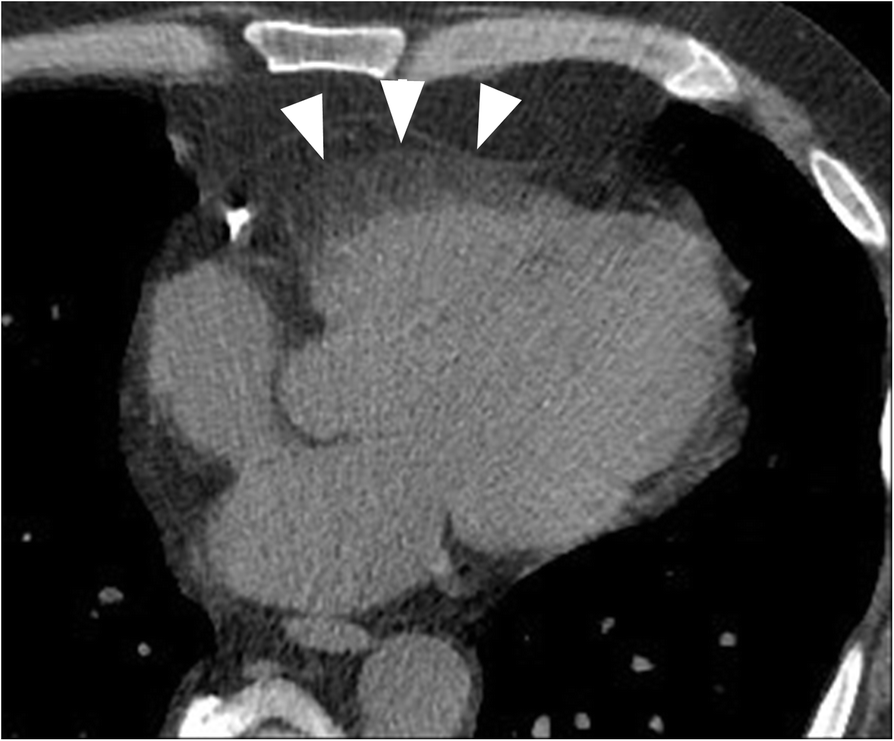 Fig. 14