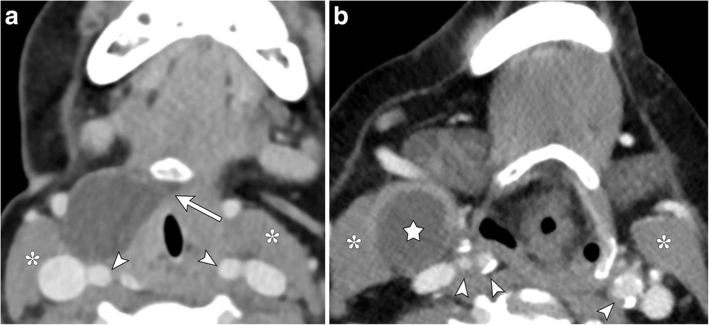 Fig. 13