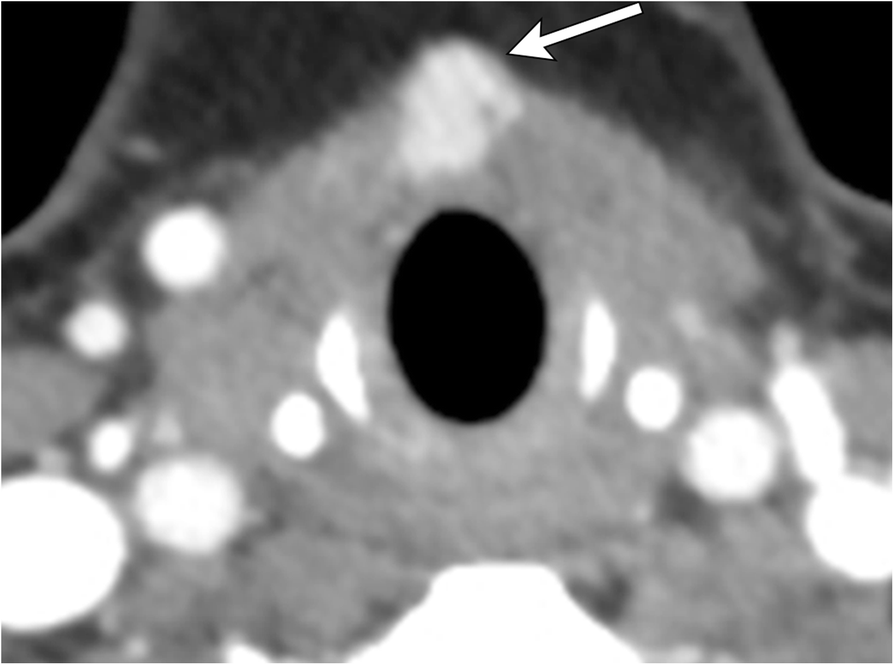 Fig. 19