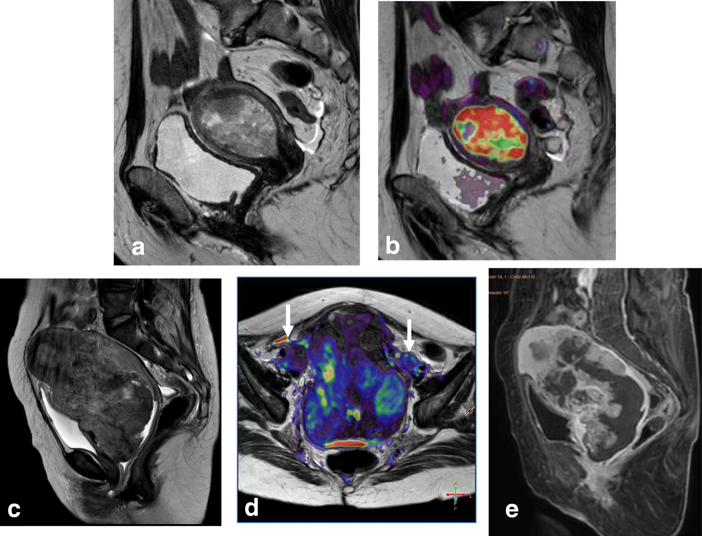 Fig. 11