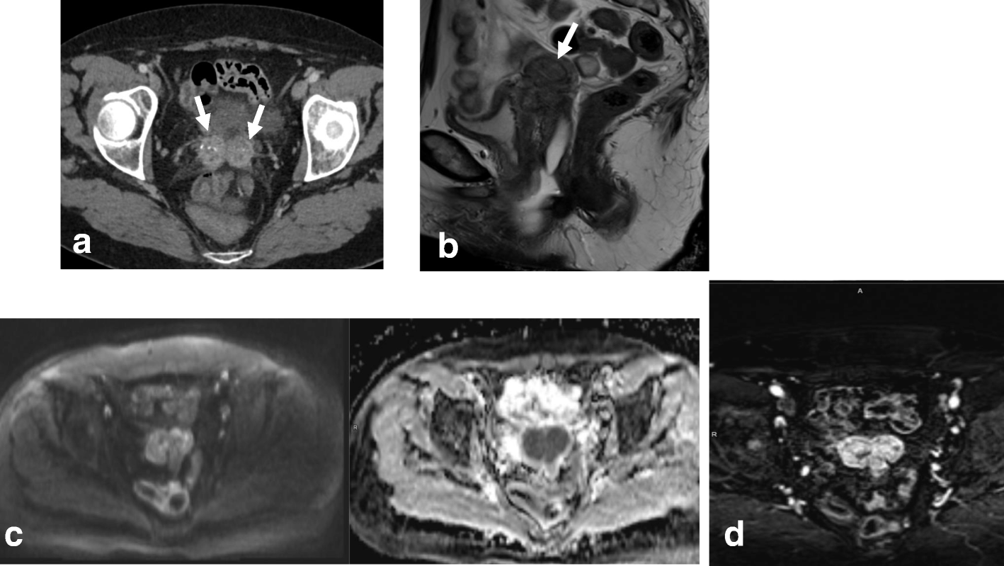 Fig. 23