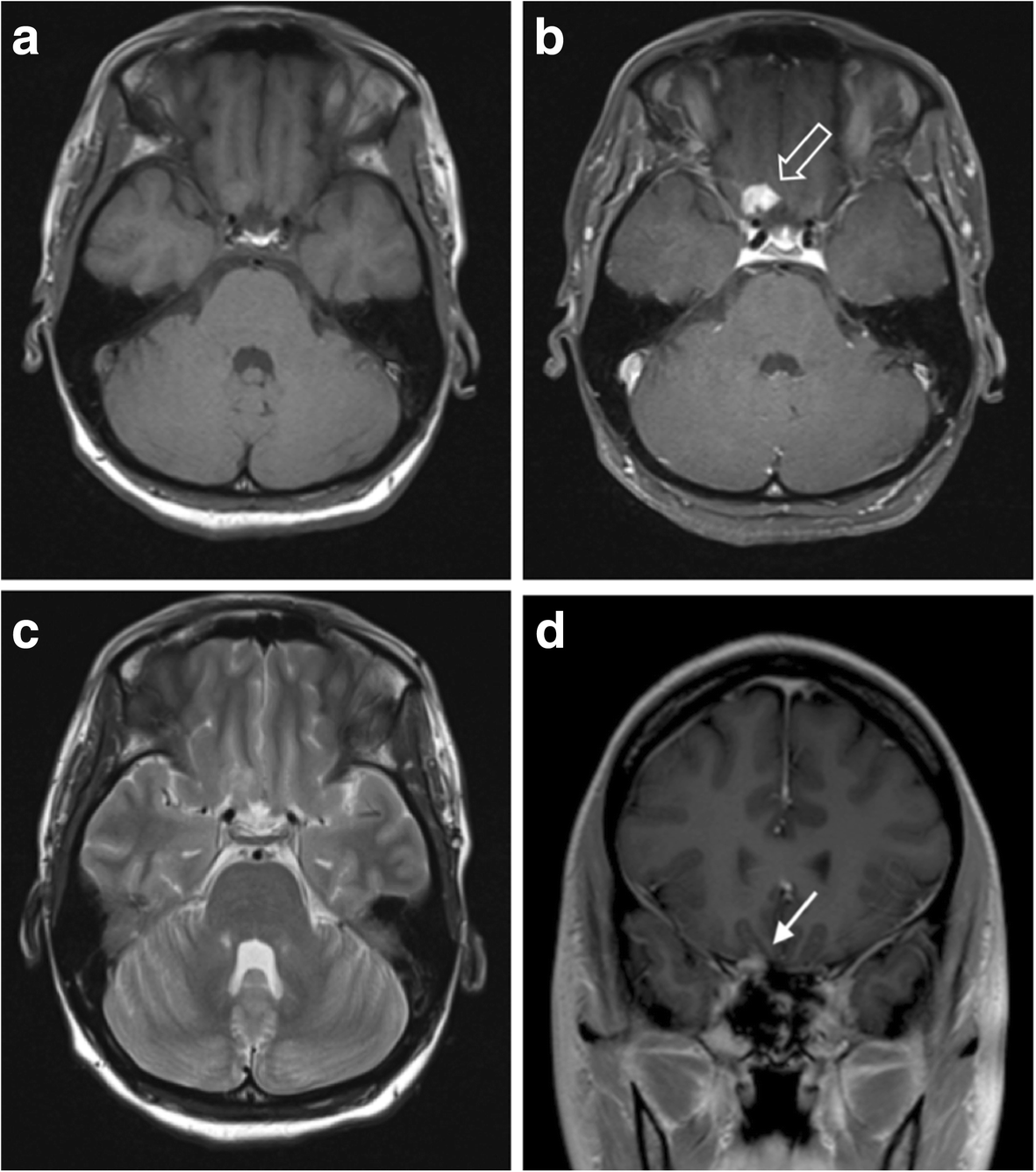 Fig. 11