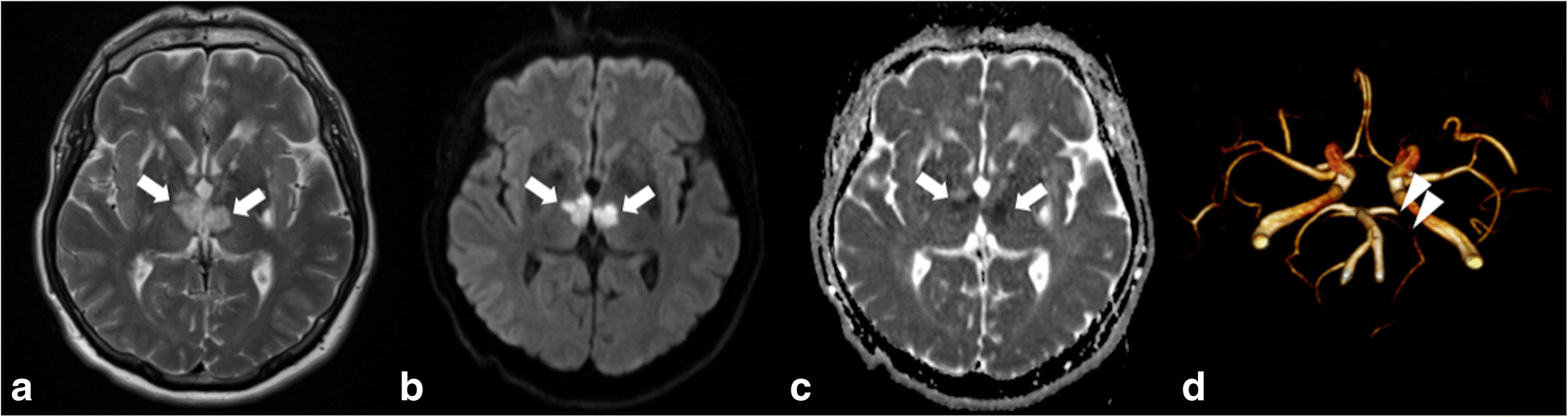 Fig. 11