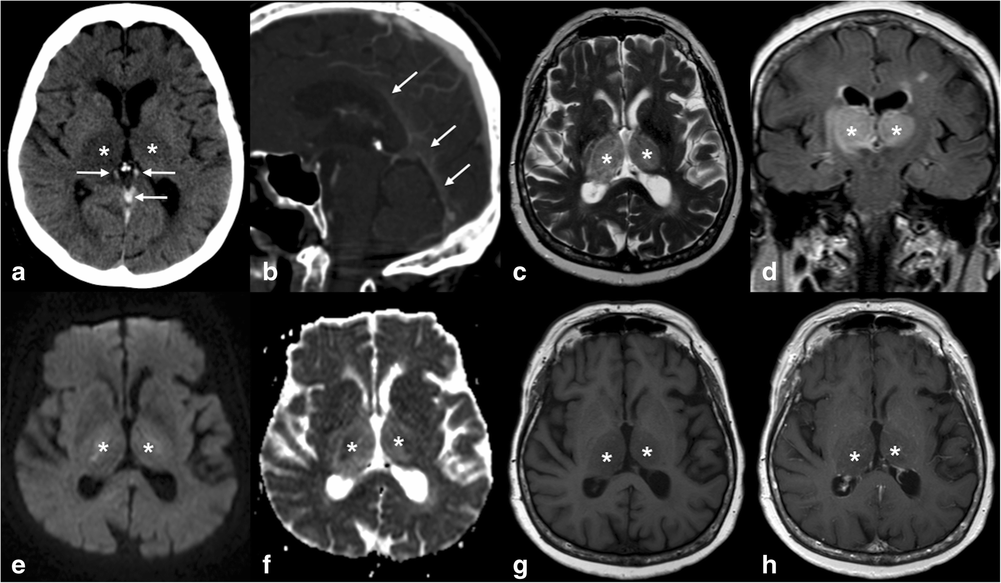 Fig. 13