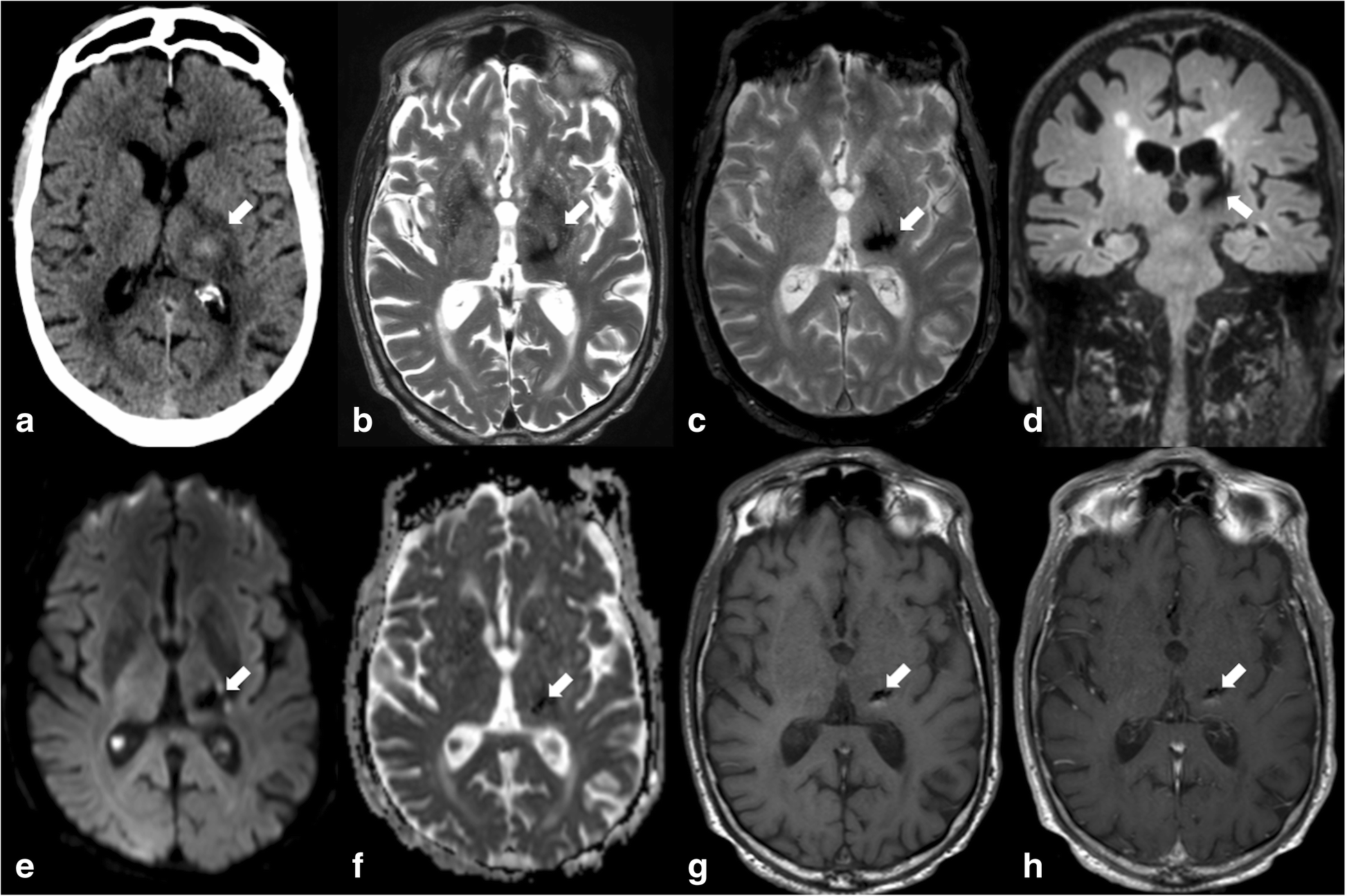 Fig. 9