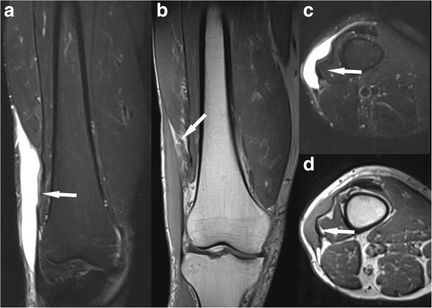 Fig. 12