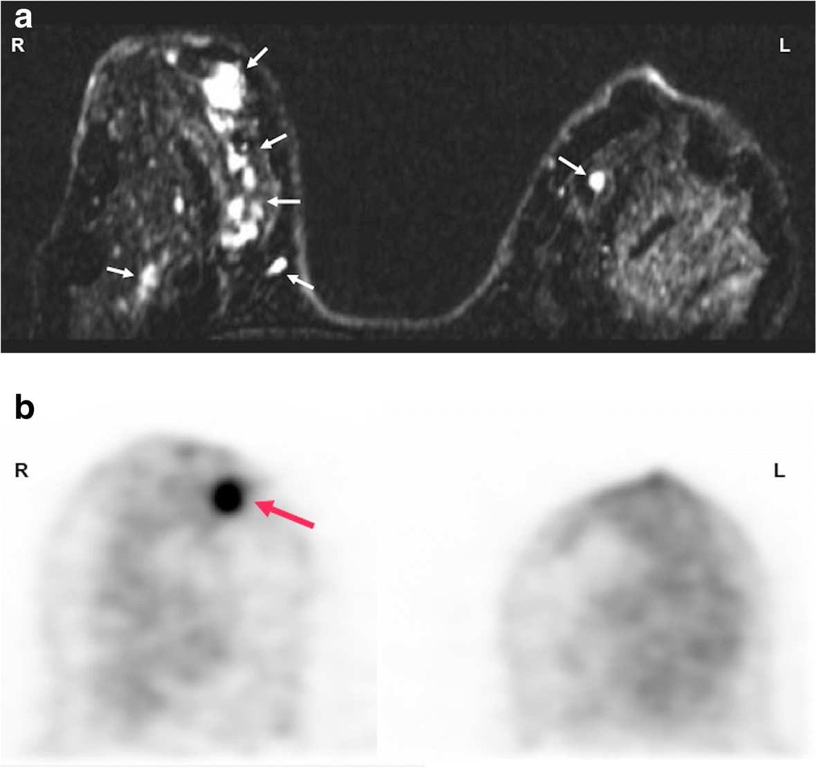 Fig. 14