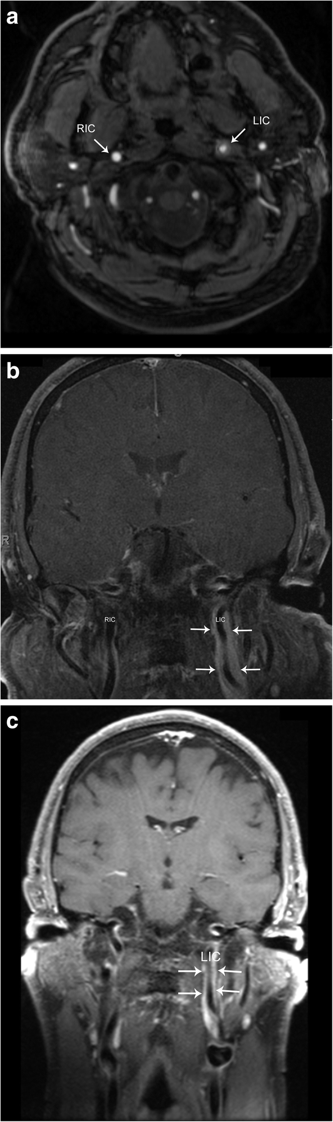 Fig. 17