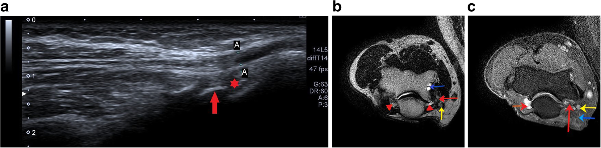 Fig. 11