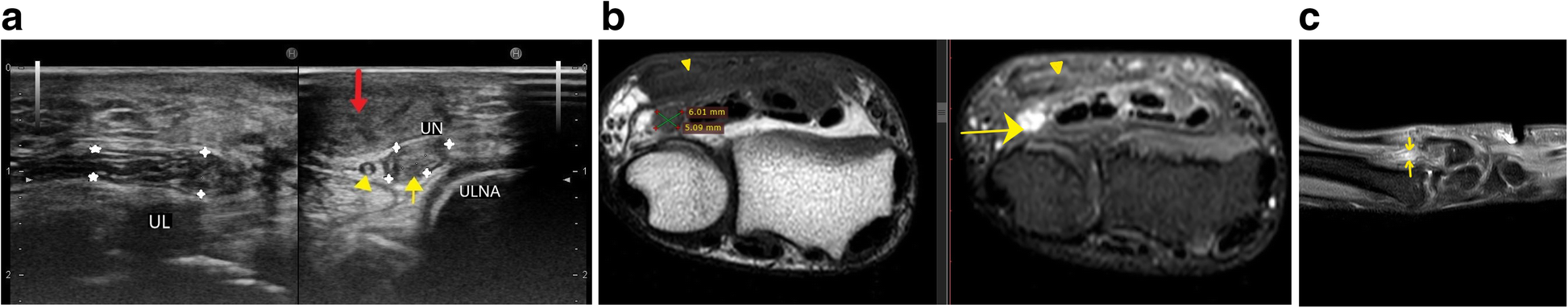 Fig. 15