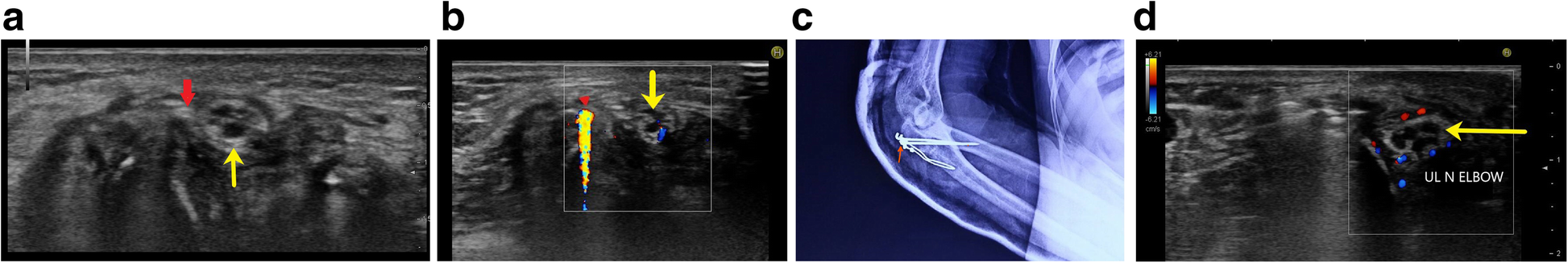 Fig. 8