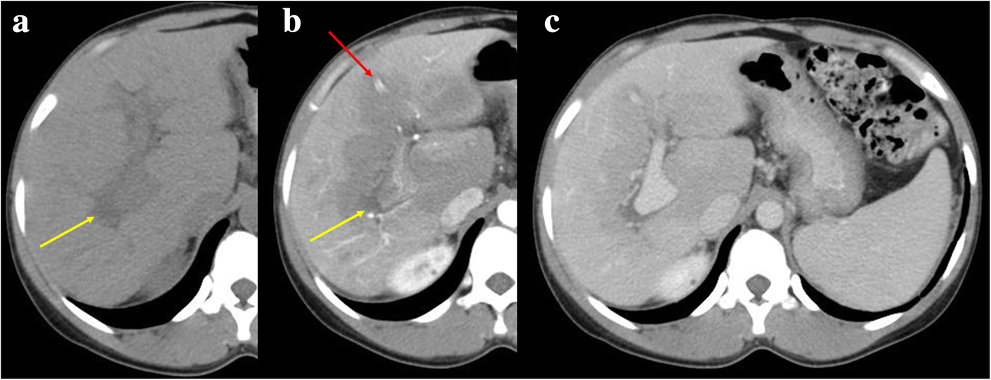 Fig. 23