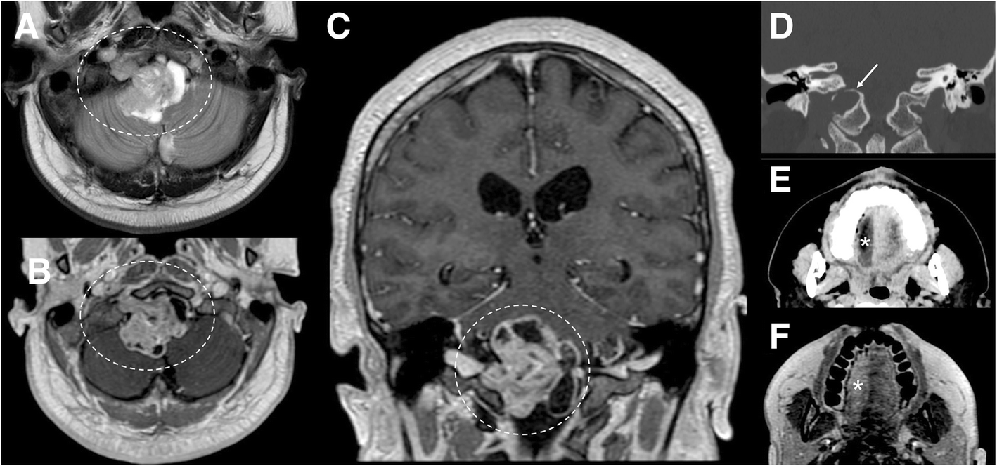 Fig. 14