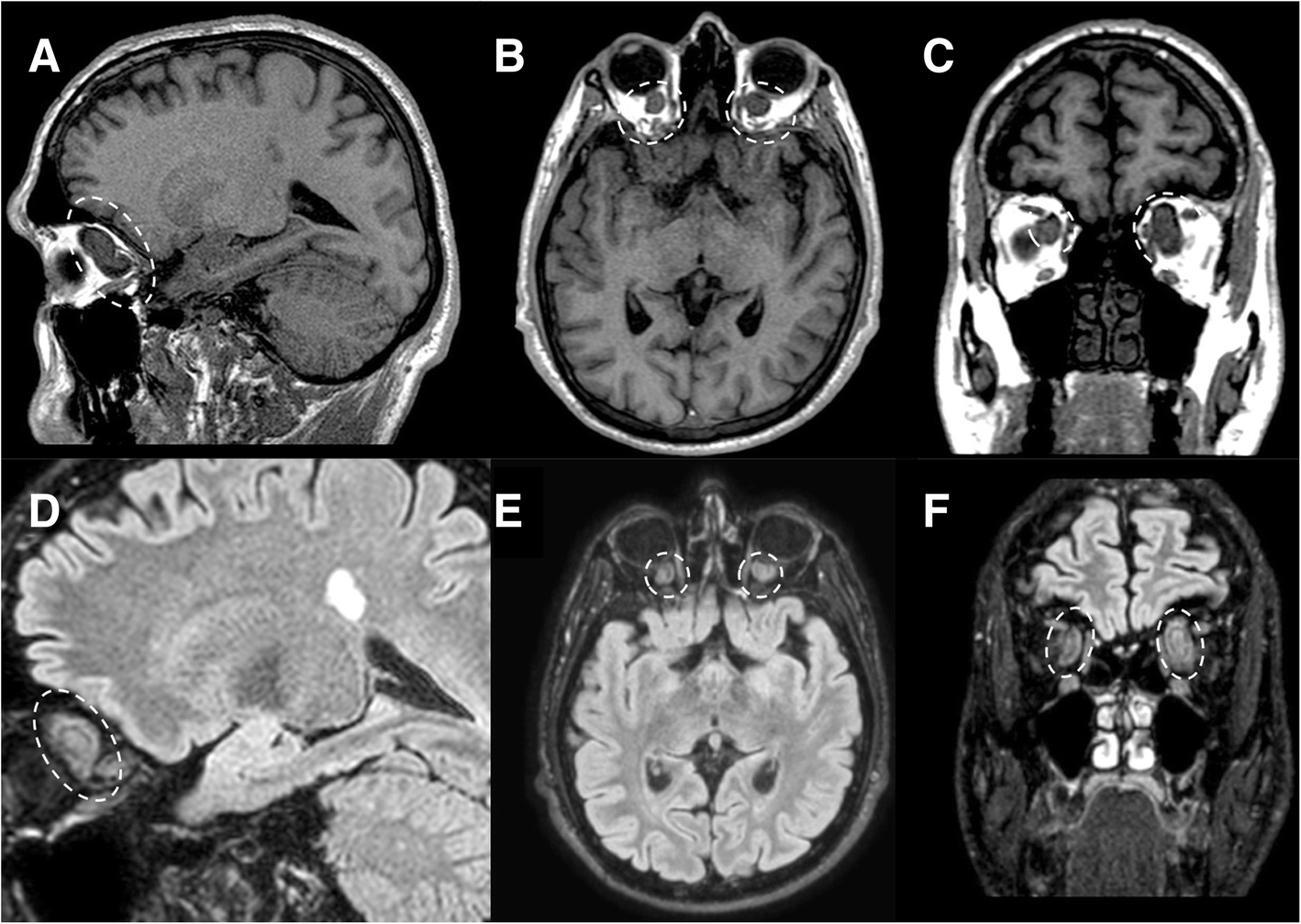 Fig. 18