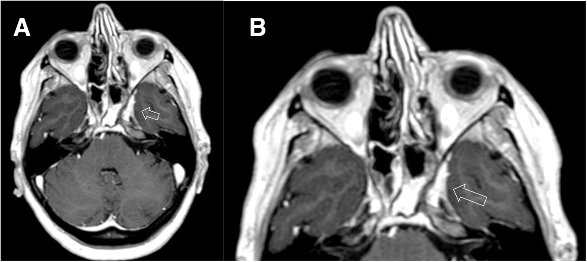 Fig. 25