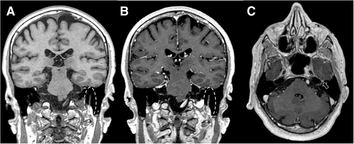 Fig. 26