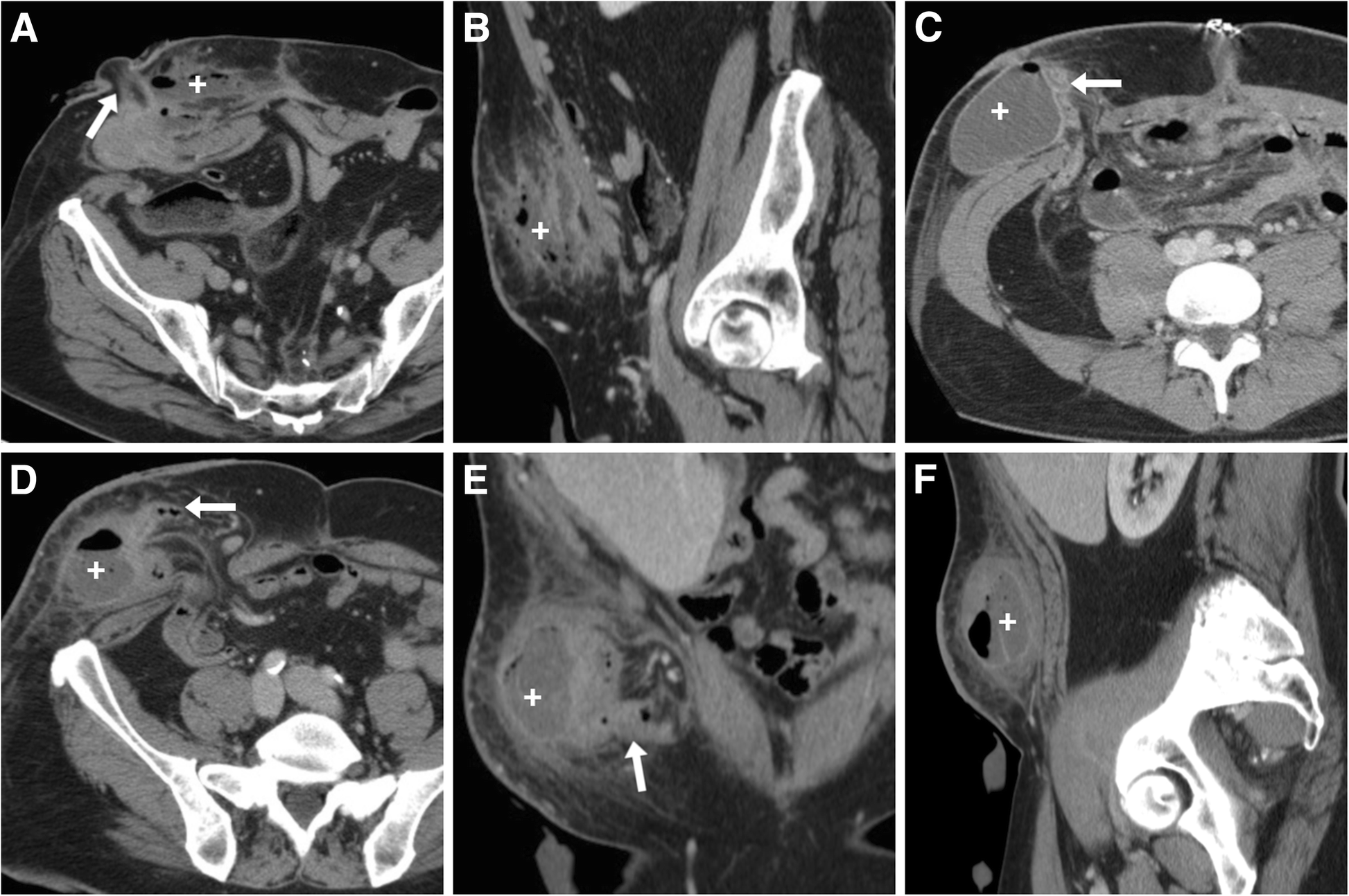 Fig. 10