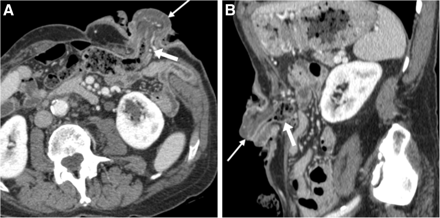 Fig. 11