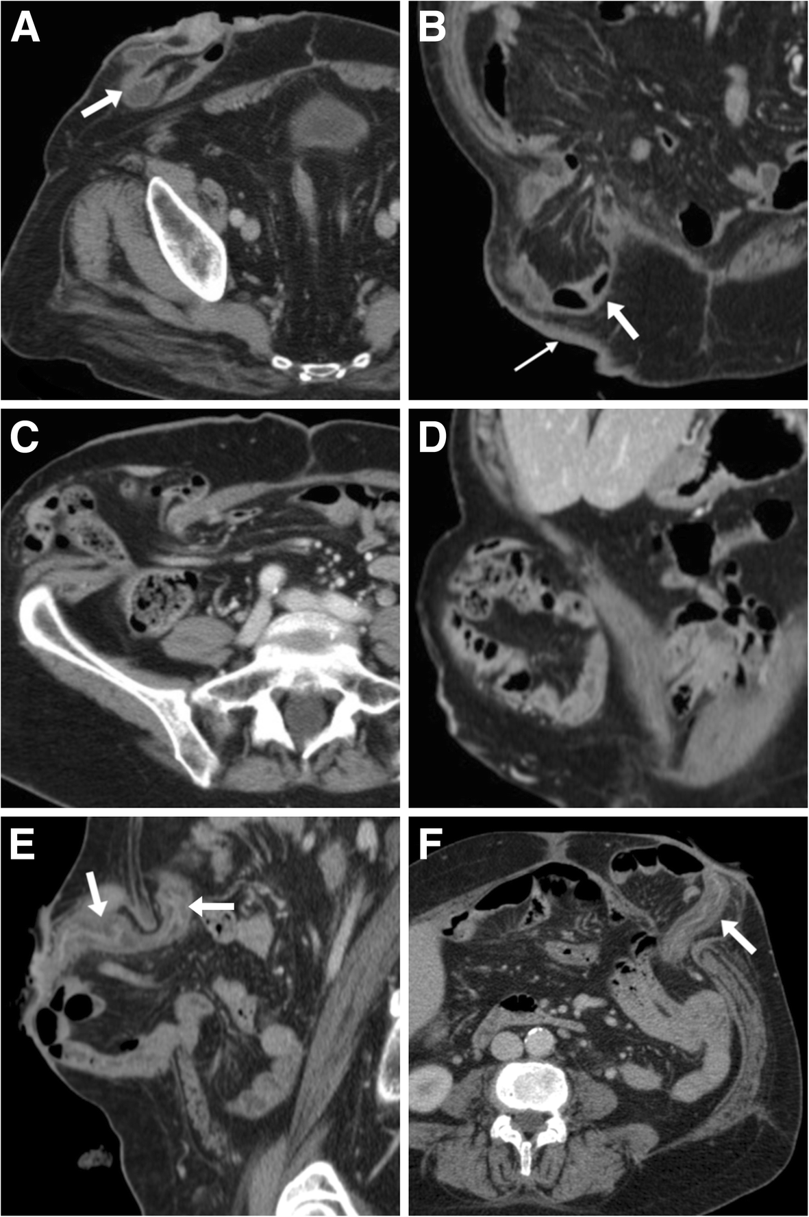 Fig. 14