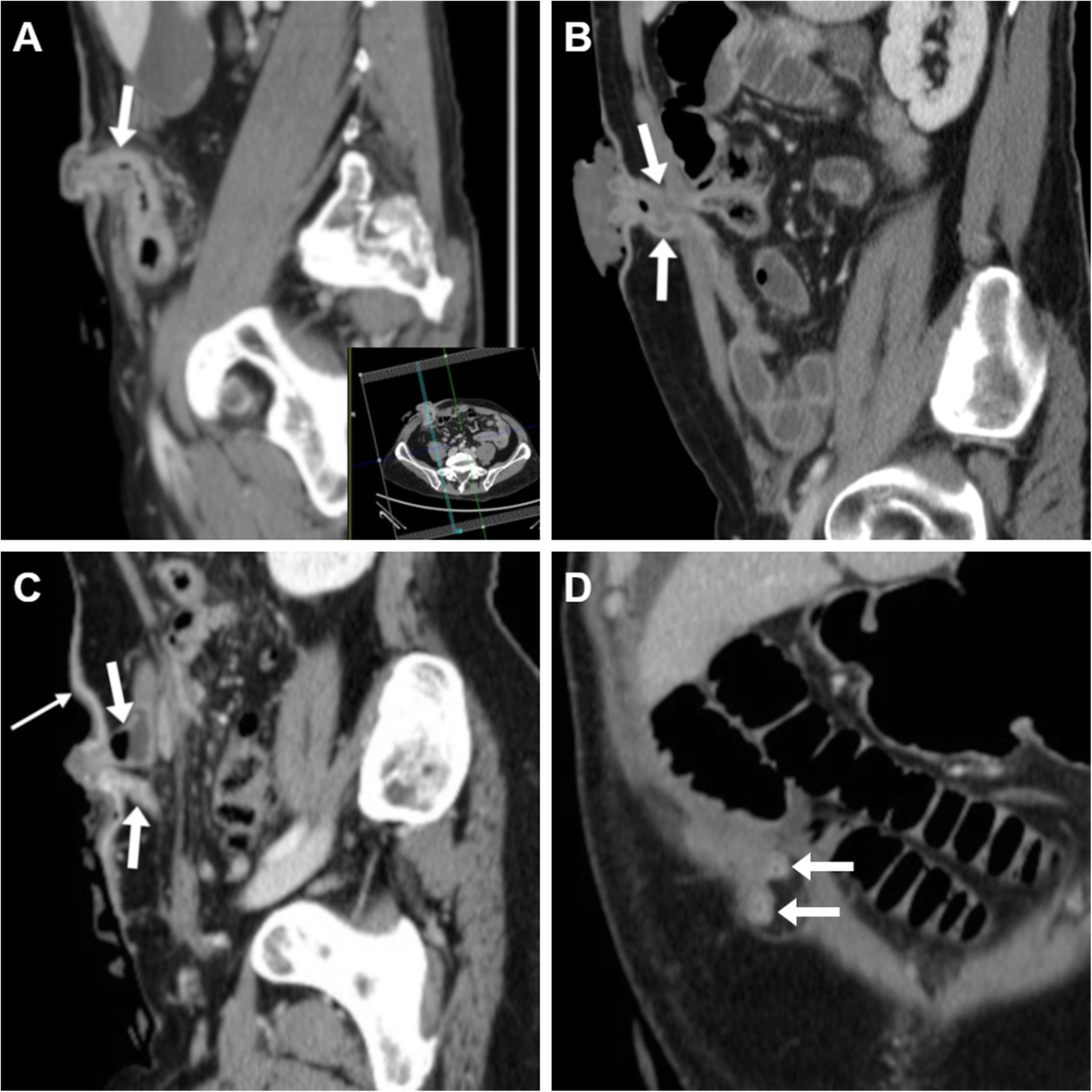 Fig. 5