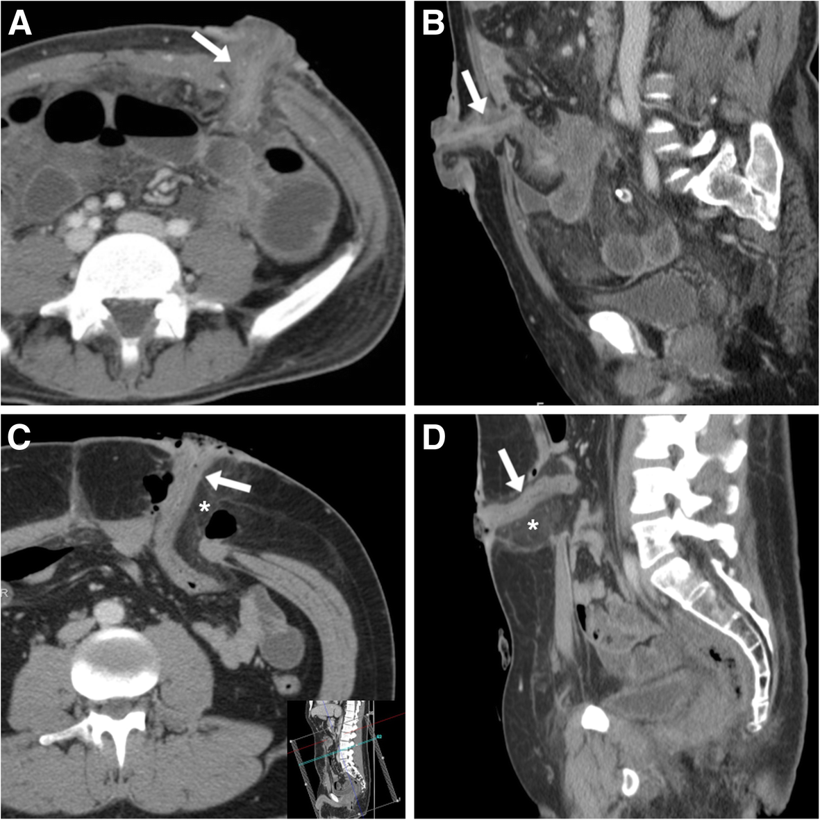 Fig. 6