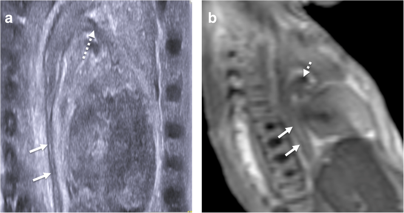 Fig. 11