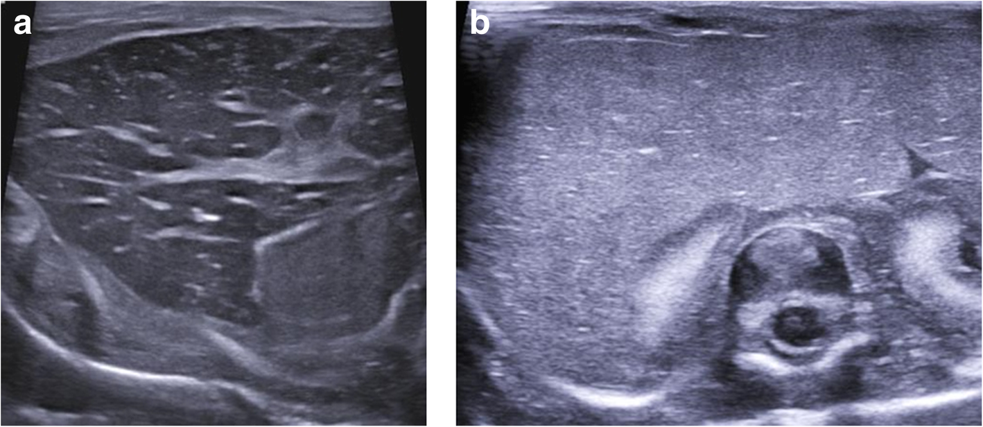 Fig. 14