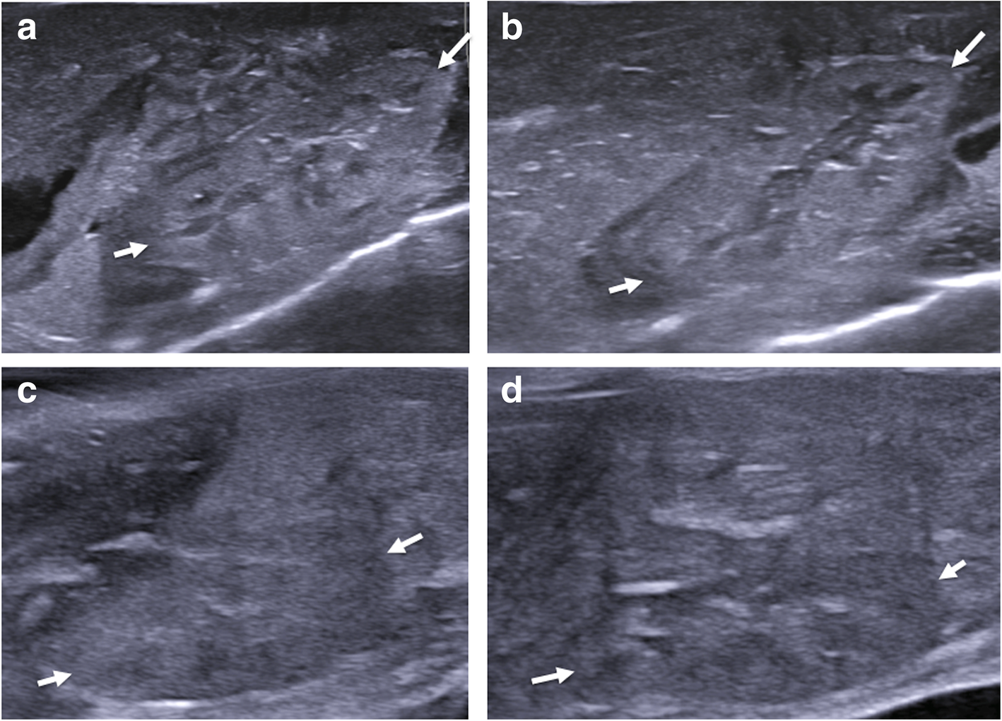 Fig. 15