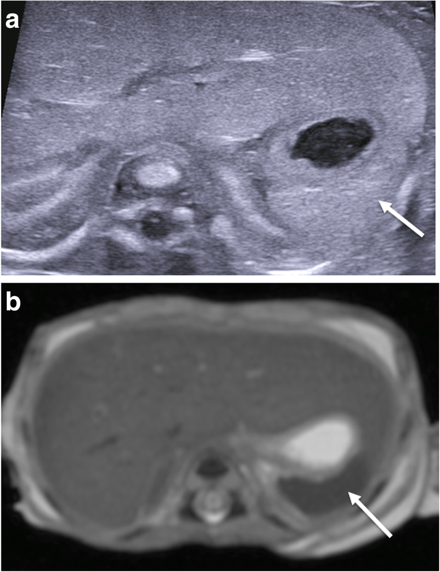 Fig. 16