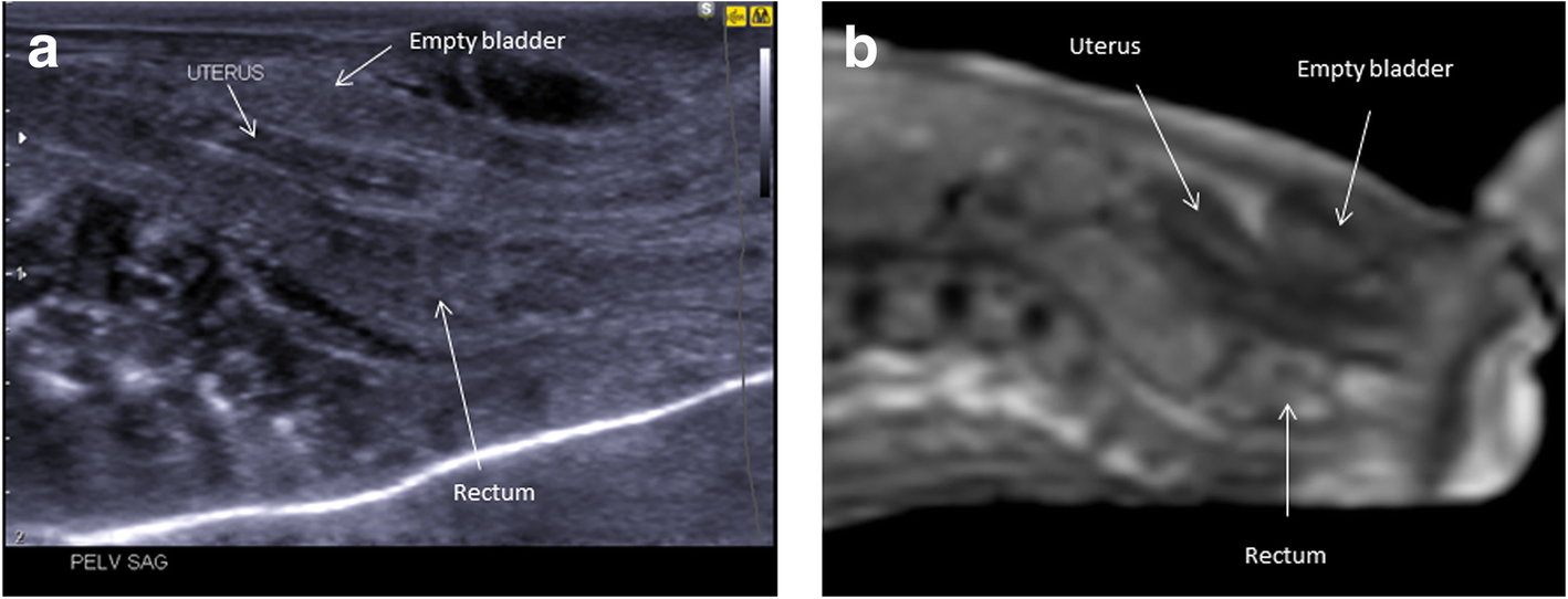 Fig. 19