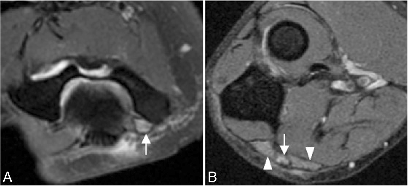 Fig. 11