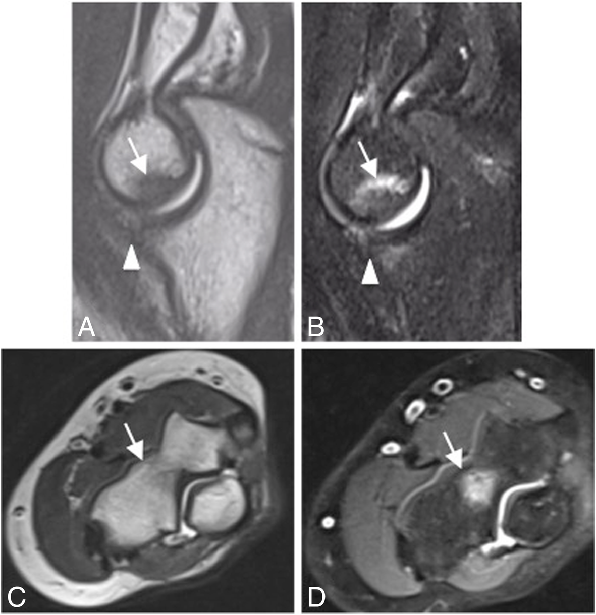 Fig. 12