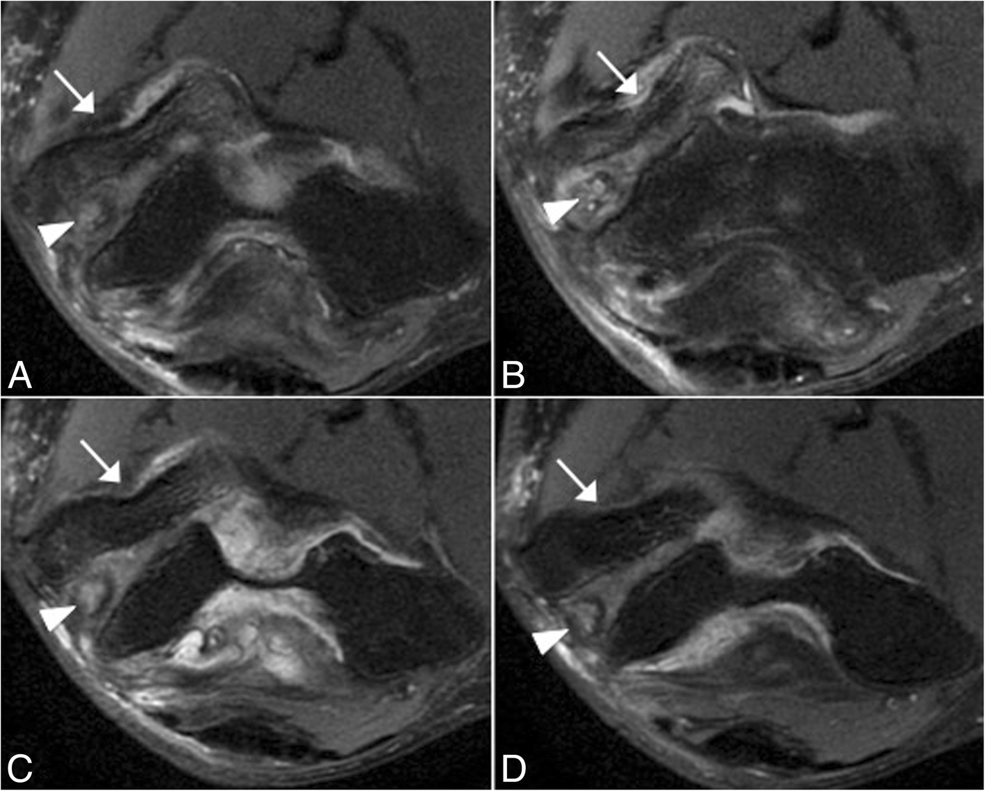 Fig. 16