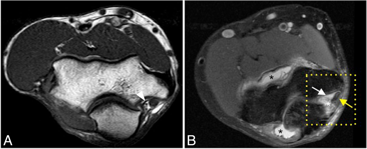 Fig. 17