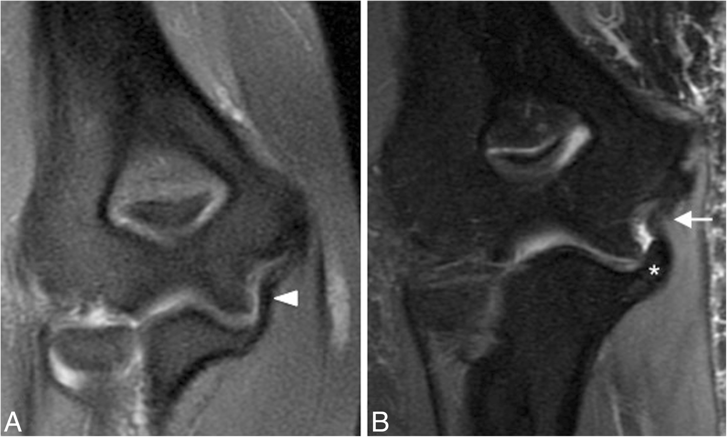 Fig. 18